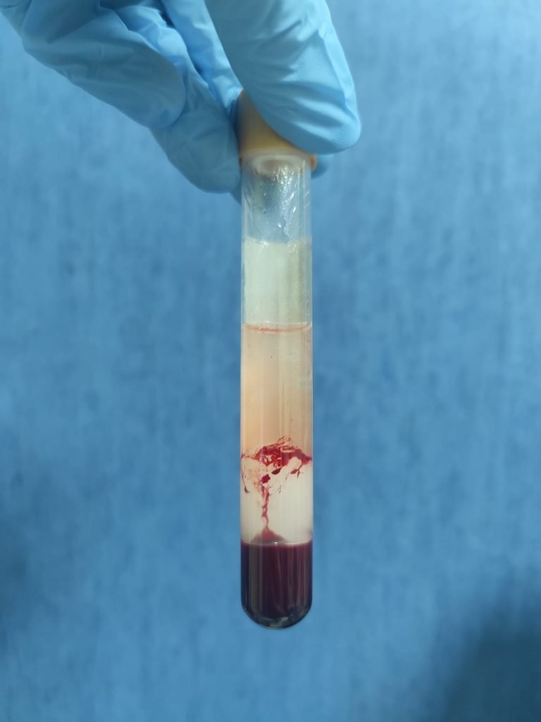 WhatsApp Image 2023-03-09 at 11.14.35 (1) WhatsApp Image 2023-03-09 at 11.14.35 (1)